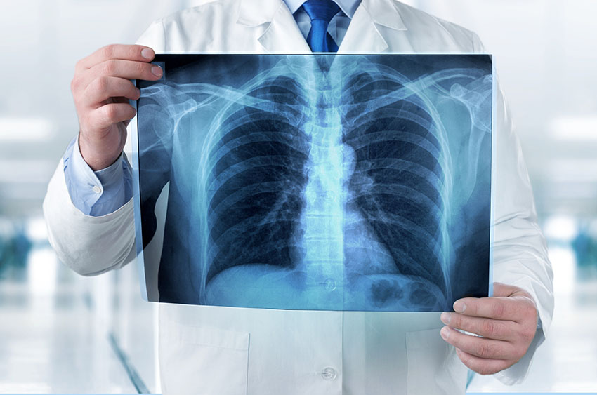 Digital X-rays